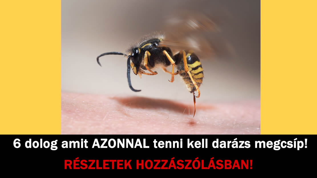 6 dolog amit AZONNAL tenni kell darázs megcsíp!